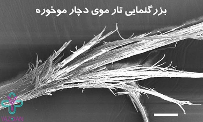 موخوره